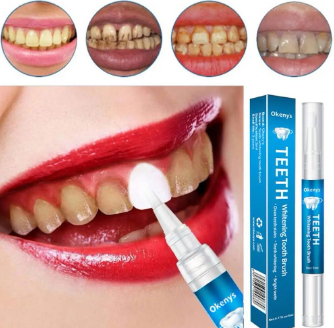 Caneta Branqueadora Dentária - EELHOE SmileWhite™ - 2 unidades