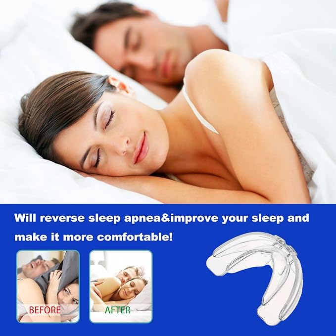 Protector Bucal Anti-Ressonar para Noites Tranquilas - SleepQuiet Pro™