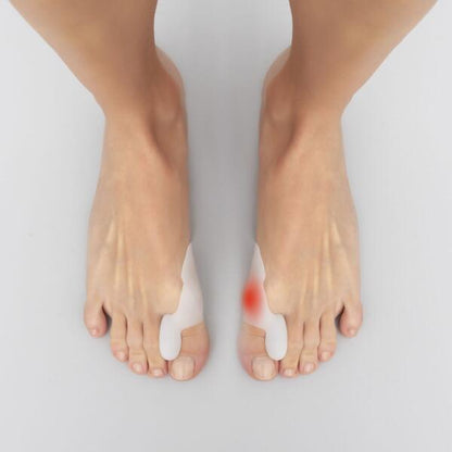 Corrector de Joanetes em Silicone - BunionFix™